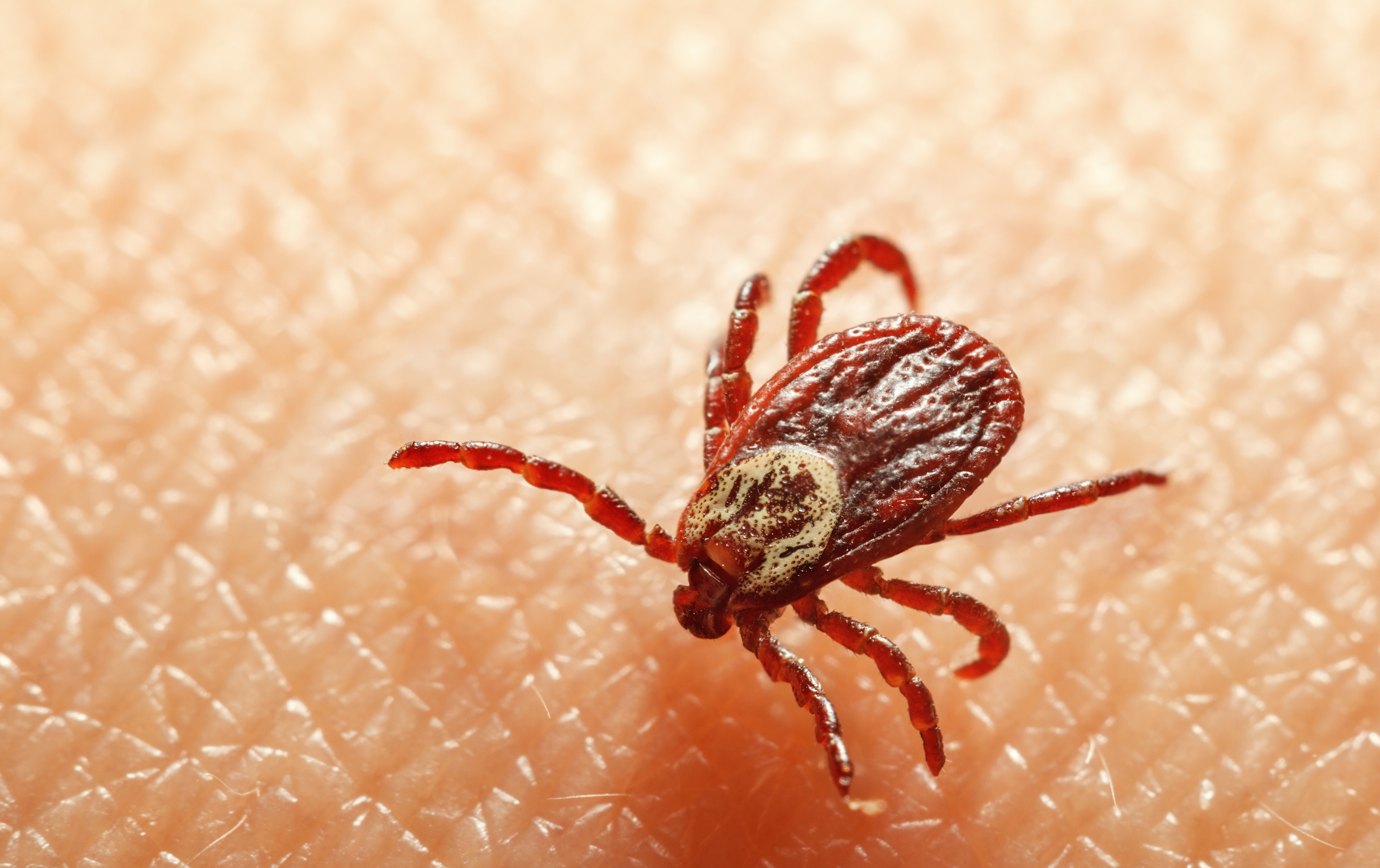 A tick on human skin.